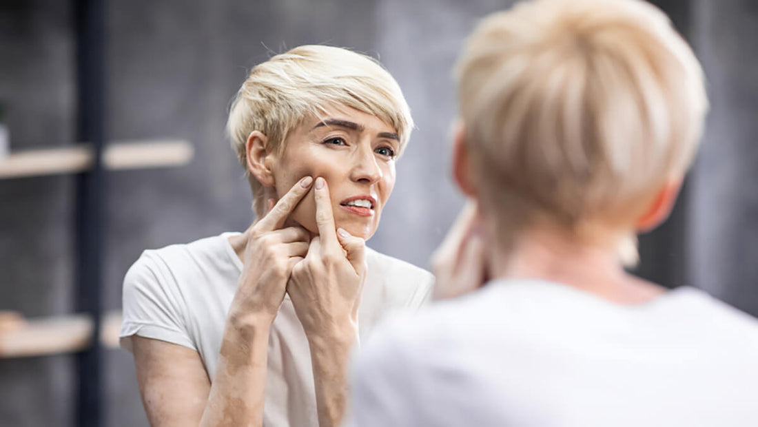 Menopausal Acne: How Does It Happen?